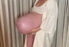 “That’s My Nightmare,” Mom’s Enormous Baby Bump That Sticks “Straight Out” Leaves People Speechless